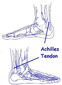 two views of the Achilles Tendon.