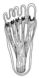 Plantar Fasciitis of the foot, from Why You Really Hurt: It All Starts In The Foot, by Dr. Burton S. Schuler