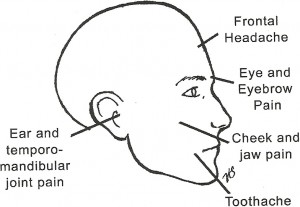 Trigger Points of head caused by Morton's Toe