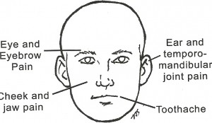 Trigger Points of the head
